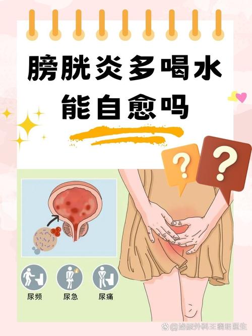 守护泌尿健康：深入了解膀胱炎