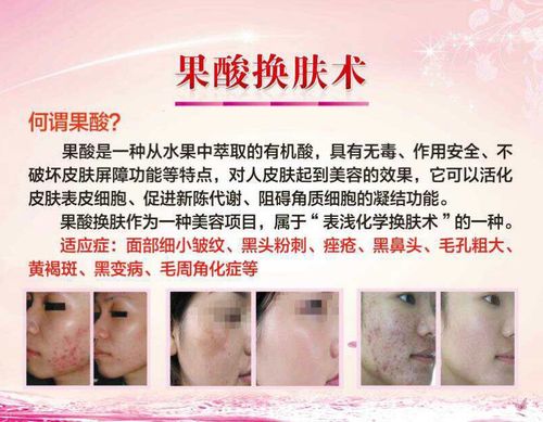 果酸焕肤：解锁细腻肌肤的神奇密码
