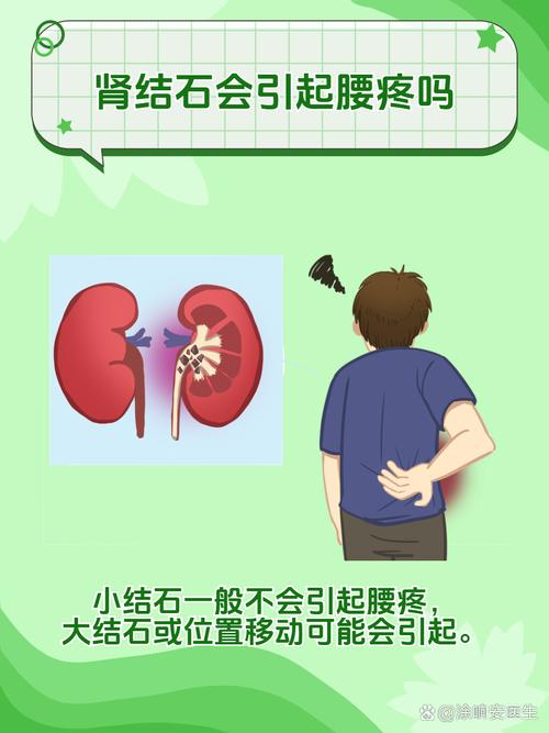 详细阅读:肾结石:泌尿系统的“不速之客” 肾结石:泌尿系统的“不速之客”