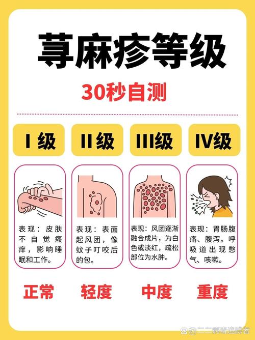 荨麻疹：了解与应对