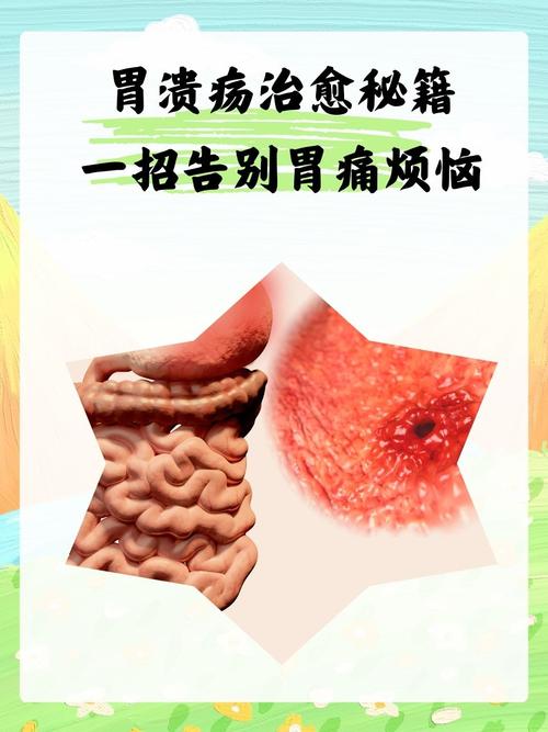 胃溃疡的治疗方法多种多样，旨在通过药物、生活方式的调整以及必要的医疗干预来缓解症状、促进溃疡愈合，并预防并发症的发生。以下是一些主要的治疗方法：