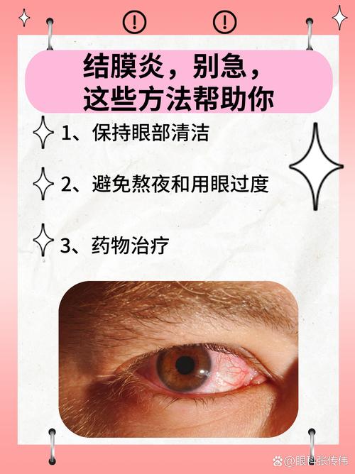 详细阅读:结膜炎的治疗与护理全攻略 结膜炎的治疗与护理全攻略