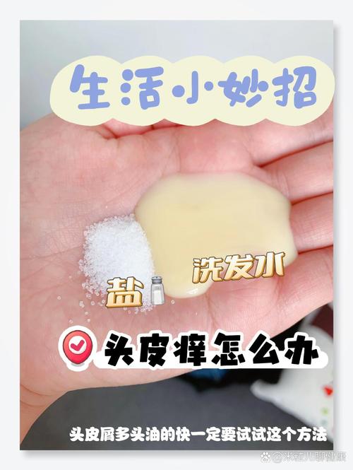 头皮瘙痒，头发护理的关键“战役”