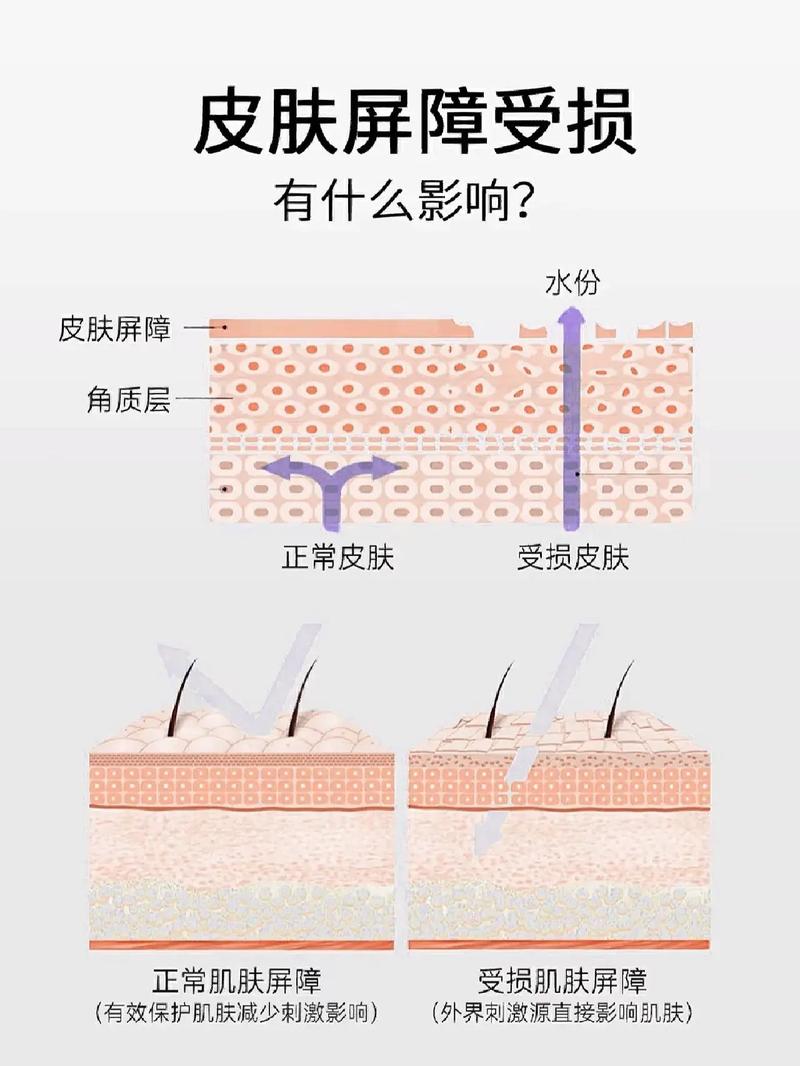详细阅读:肌肤的守护:深度解析皮肤屏障修复的奥秘与实践 肌肤的守护:深度解析皮肤屏障修复的奥秘与实践