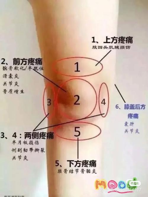 详细阅读:韧带拉伤:原因、症状、诊断与康复全解析 韧带拉伤:原因、症状、诊断与康复全解析