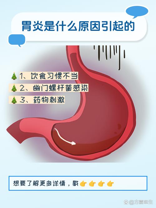 胃炎：警惕“小胃病”背后的大隐患