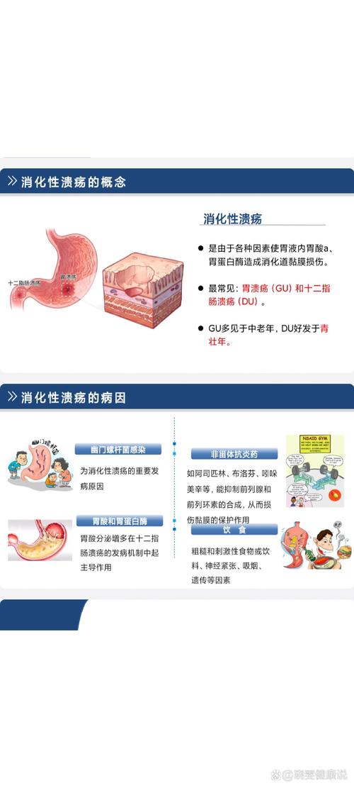 胃溃疡：症状、病因与治疗全解析