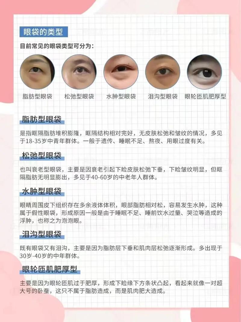 详细阅读:眼部眼袋消除:告别疲惫,重焕眼部光彩 眼部眼袋消除:告别疲惫,重焕眼部光彩