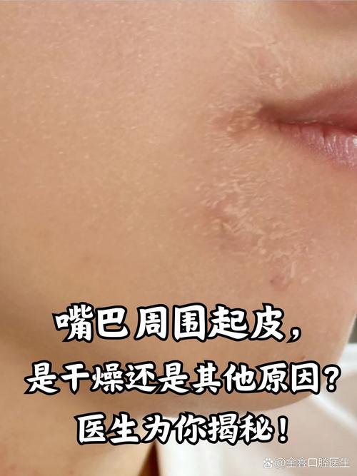 详细阅读:唇部肌肤抗干裂全攻略:守护娇嫩双唇,告别干裂烦恼 唇部肌肤抗干裂全攻略:守护娇嫩双唇,告别干裂烦恼