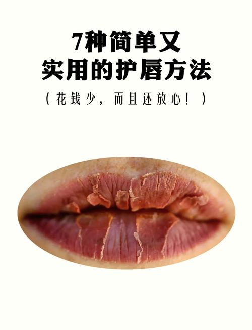 唇部肌肤抗氧化：守护双唇的鲜嫩与健康