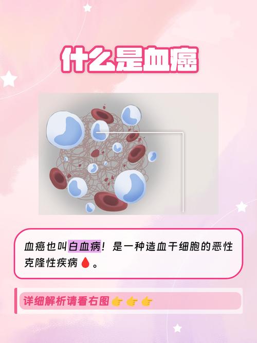 详细阅读:白血病:无情的“血癌”,你了解多少? 白血病:无情的“血癌”,你了解多少?