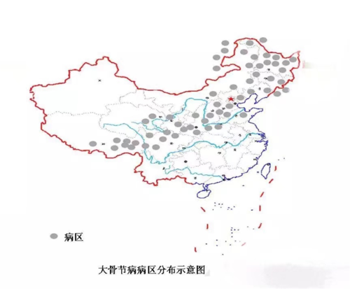 详细阅读:地方病:地域性健康挑战的深度解析 地方病:地域性健康挑战的深度解析