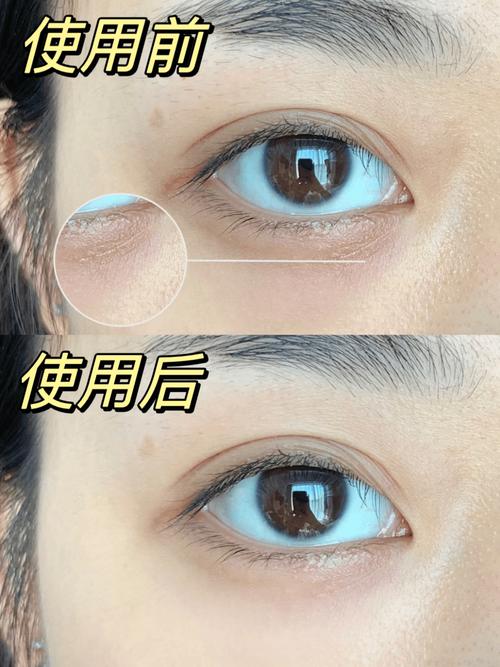 详细阅读:探秘眼霜消除眼袋的奥秘:重绽双眸青春光彩 探秘眼霜消除眼袋的奥秘:重绽双眸青春光彩