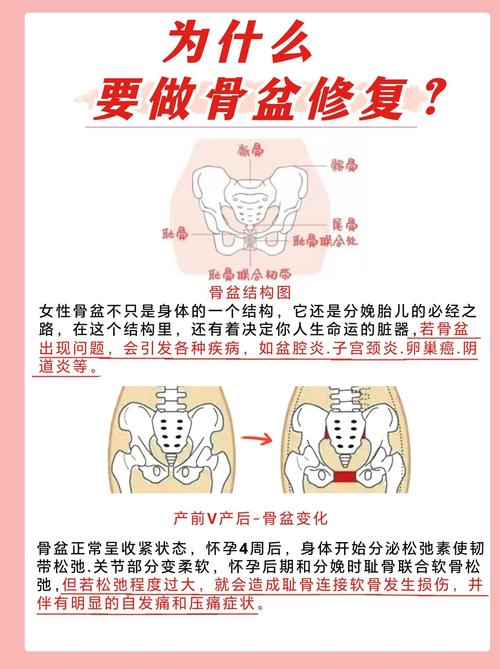 产后骨盆修复带：重塑身材，守护健康