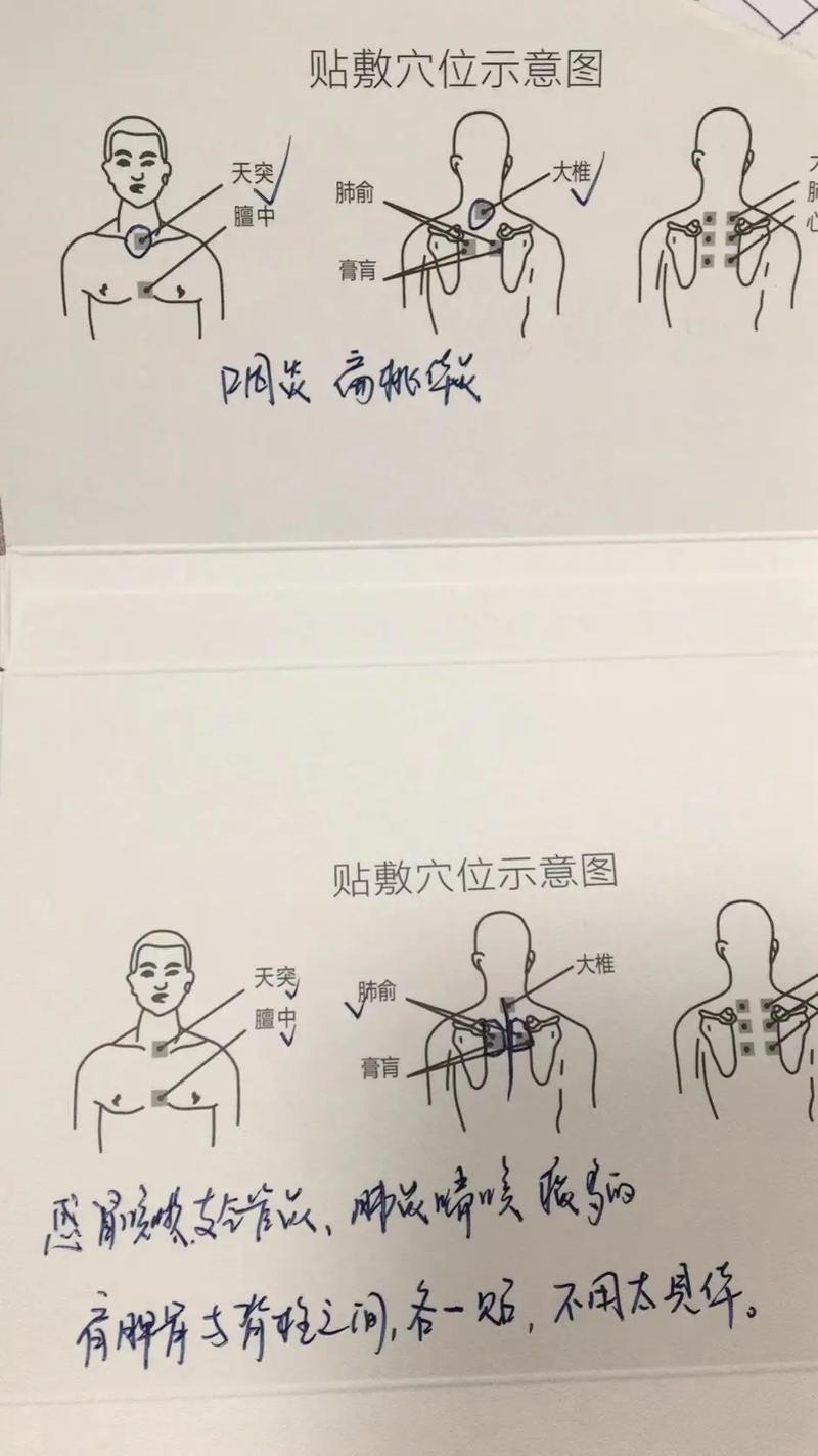 详细阅读:宝宝防咳嗽:守护稚嫩娇音的全方位攻略 宝宝防咳嗽:守护稚嫩娇音的全方位攻略