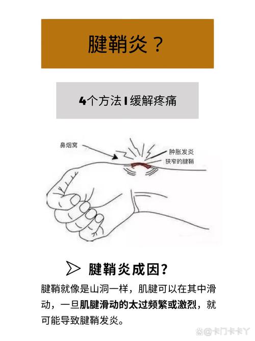 详细阅读:腱鞘炎:告别疼痛,重拾生活活力的多元治疗之道 腱鞘炎:告别疼痛,重拾生活活力的多元治疗之道