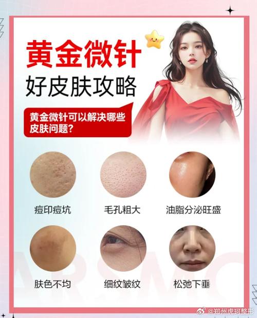 黄金微针抗衰紧致：解锁肌肤年轻密码，焕启时光逆旅新程
