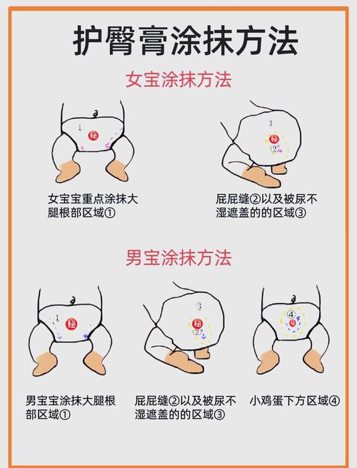 守护宝宝娇嫩屁屁，远离红屁屁烦恼——必备护臀膏全解析