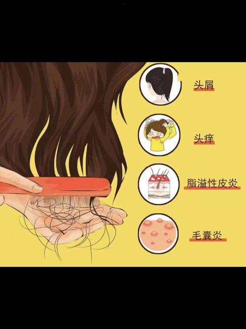 头发护理常识,头发护理常识大全