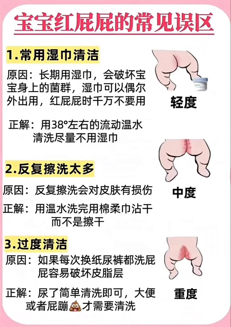 宝宝防红屁屁,宝宝防红屁屁用油状好还是乳状好