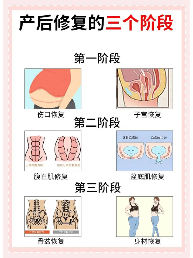 产后骨盆带,产后骨盆带有用吗