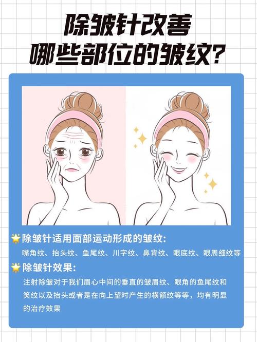 肉毒素除皱功效与适用范围,肉毒素除皱功效与适用范围图片