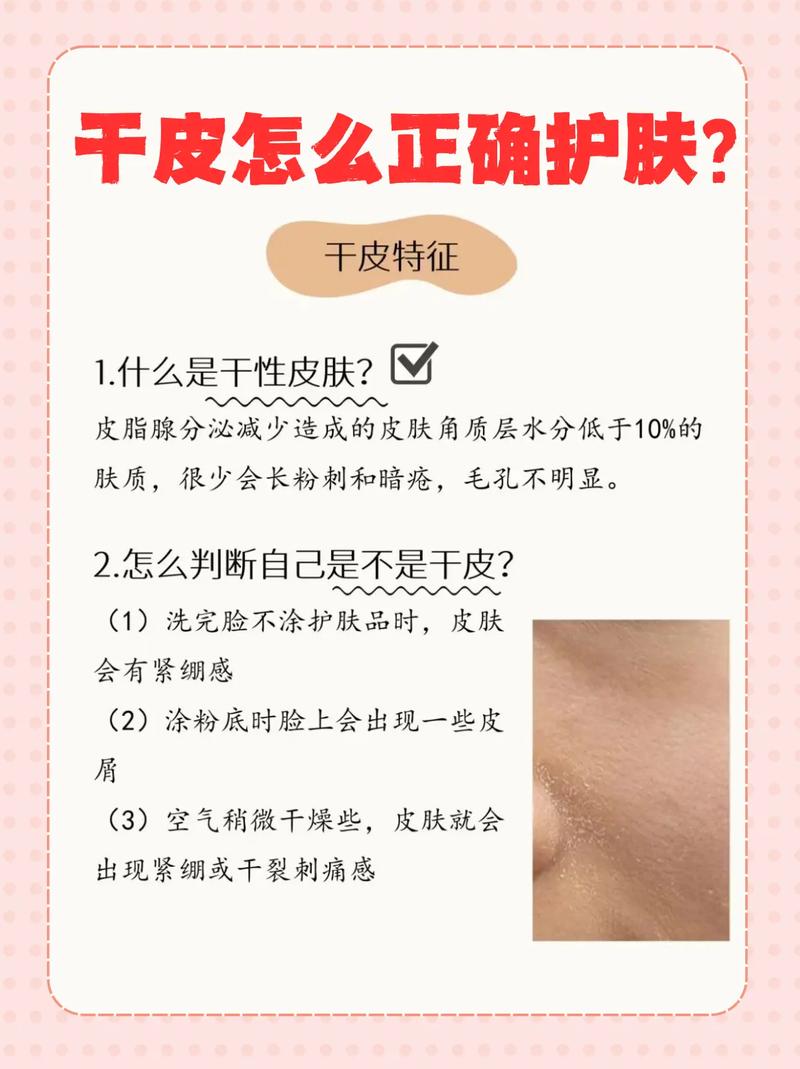 干性肤质辨别,干性皮肤怎么辨别