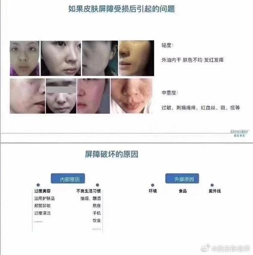 肌肤屏障健康,肌肤屏障健康和油脂均衡的人看起来会怎么样