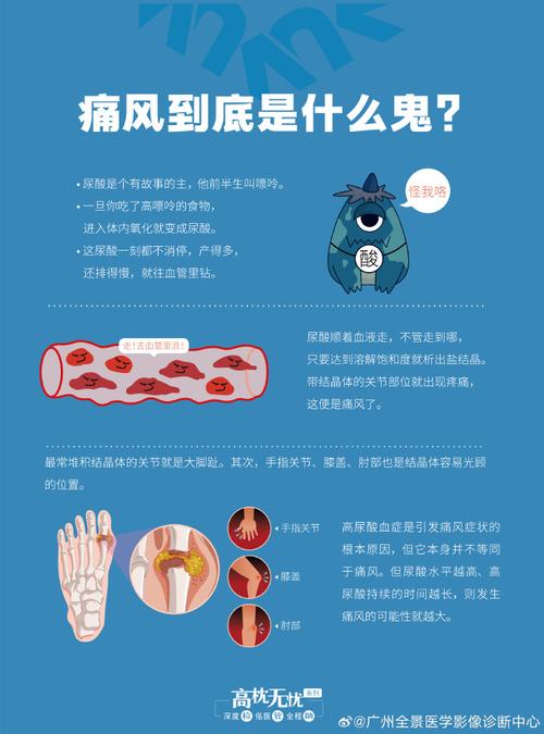 痛风的治疗与预防,痛风的治疗与预防方法
