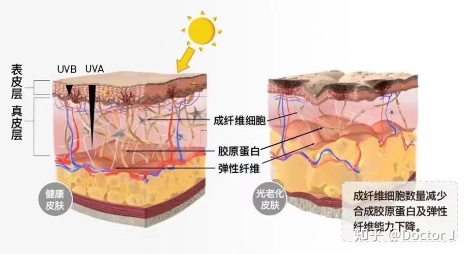 皮肤光老化防护,皮肤光老化防护方法